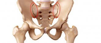Arthrosis of the sacroiliac joint - causes of development