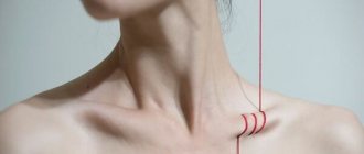 Pain in the collarbone area