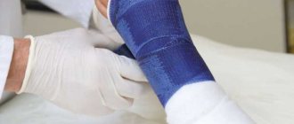 What to do if swelling and severe pain appear after removing the cast from your arm