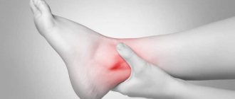 What is ankle bursitis?