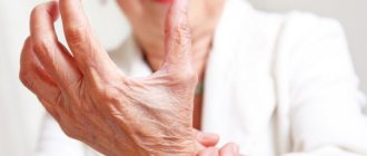 Using ointments for arthritis will help relieve pain