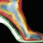 A heel higher than 5 cm is a huge danger to the joints