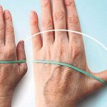 How to develop a finger after a fracture. Best Practices 
