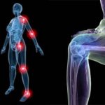 How to strengthen joints and ligaments: remedies and exercises