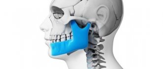 Treatment for a broken jaw