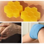 Treatment with beeswax for joint diseases