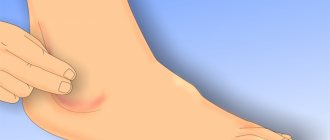 Лодыжка - часть голеностопного сустава