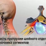 Danger of cervical spine protrusion