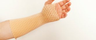 Orthoses for the wrist joints for carpal tunnel syndrome