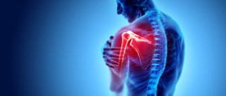 Osteoarthritis of the shoulder joint