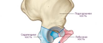 Перелом седалищной кости: лечение, последствия, реабилитация