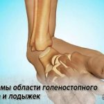 Fractures of the ankle and ankle area