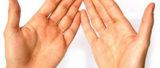 Полиостеоартроз пальцев рук