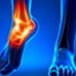 The causes of unpleasant pain in the ankle area are difficult for the average person to understand, and very often this is not given due importance. However, if even minor discomfort occurs, it is advisable to consult a doctor. 