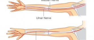 ulnar nerve compression