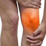 synovitis of the knee joint