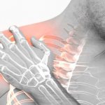 tendonitis of the supraspinatus tendon of the shoulder joint