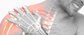 тендинит сухожилия надостной мышцы плечевого сустава
