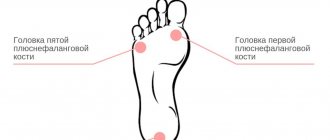 Foot support points