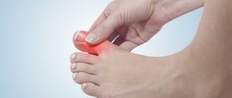 A bruised toe usually occurs due to a household or sports injury.